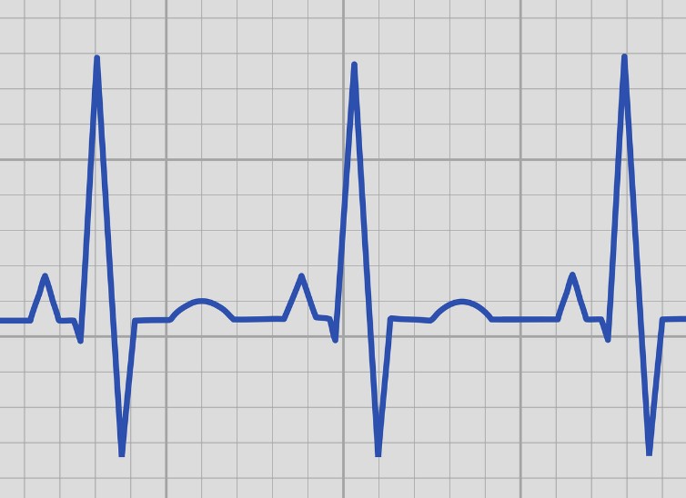 ECG